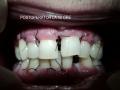 Parodontologie