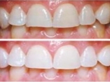 Stomprax Medica - Estetica dentara